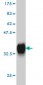 PITX1 Antibody (monoclonal) (M01)