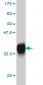 PITX1 Antibody (monoclonal) (M01)