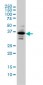 PITX1 Antibody (monoclonal) (M01)