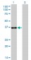 PITX1 Antibody (monoclonal) (M01)