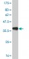 PITX1 Antibody (monoclonal) (M02)