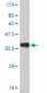 PITX1 Antibody (monoclonal) (M02)