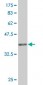 PKNOX1 Antibody (monoclonal) (M01)