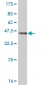 PKNOX1 Antibody (monoclonal) (M04)