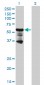 PKNOX2 Antibody (monoclonal) (M01)