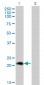 PLA2G12A Antibody (monoclonal) (M01)