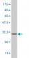 PLA2G1B Antibody (monoclonal) (M14)