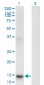 PLA2G1B Antibody (monoclonal) (M14)