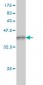 PLA2G4A Antibody (monoclonal) (M01)