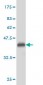 PLD2 Antibody (monoclonal) (M01)
