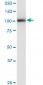 PLD2 Antibody (monoclonal) (M01)