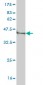 PLEC1 Antibody (monoclonal) (M02)