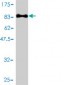 PLK1 Antibody (monoclonal) (M01)