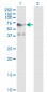 PLK1 Antibody (monoclonal) (M01)