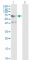 PLK1 Antibody (monoclonal) (M01)