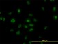 PLK1 Antibody (monoclonal) (M04)