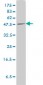 PLTP Antibody (monoclonal) (M01)