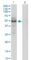 PLTP Antibody (monoclonal) (M01)