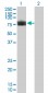 PLXDC1 Antibody (monoclonal) (M01)