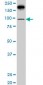 PML Antibody (monoclonal) (M02)