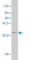 PMM2 Antibody (monoclonal) (M01)