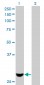 PMM2 Antibody (monoclonal) (M01)