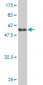 PMM2 Antibody (monoclonal) (M02)