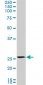 PMM2 Antibody (monoclonal) (M02)