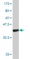 PNPLA2 Antibody (monoclonal) (M01)