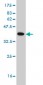 POLE2 Antibody (monoclonal) (M01)