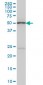 POLE2 Antibody (monoclonal) (M01)
