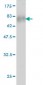 POLR1C Antibody (monoclonal) (M05)