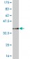 PPARBP Antibody (monoclonal) (M05)