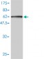 PPARD Antibody (monoclonal) (M01)