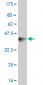 PPARD Antibody (monoclonal) (M03)