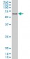 PPARD Antibody (monoclonal) (M03)