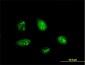 PPARGC1A monoclonal antibody (M02), clone 3B5