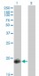 PPP1R14A Antibody (monoclonal) (M01)