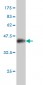 PRDM1 Antibody (monoclonal) (M01)