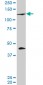 PRDM1 Antibody (monoclonal) (M01)