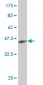 PRDM1 Antibody (monoclonal) (M04)