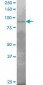 PRDM1 Antibody (monoclonal) (M04)