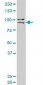 PRDM1 Antibody (monoclonal) (M04)