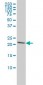 PRDX2 Antibody (monoclonal) (M01)