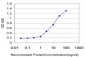 PRDX5 Antibody (monoclonal) (M01)