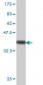 PRKAR2A Antibody (monoclonal) (M01)