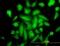 PRKCA Antibody (monoclonal) (M01)