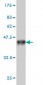 PRKCBP1 Antibody (monoclonal) (M01)