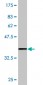 PRKCBP1 Antibody (monoclonal) (M06)