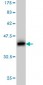PRKCD Antibody (monoclonal) (M06)